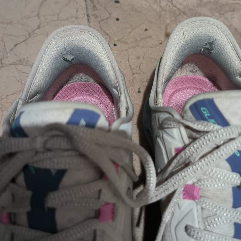 Skechers Ayakkabısının Üç Ay İçinde Topuk Yırtılması Ve Haksız Kullanıcı Hatası