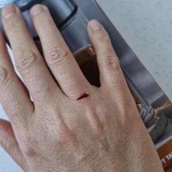 Patlayan Demlik Termos Ve Mağaza İade Sürecindeki Sorgulayıcı Tutum