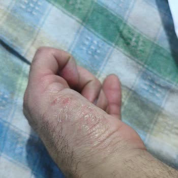 Arby's Müdürünün Çalışana Gıda Sektöründe Çalışamaz Notu Koyması Ve Kaldırılması Talebi