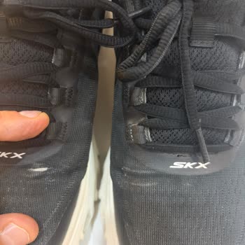 Skechers Ayakkabısında Tek Tek Yırtılma Ve Değişim Talebinin Reddedilmesi