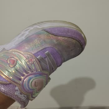 Skechers Çocuk Ayakkabısının Kısa Sürede Aşırı Yıpranması Ve Değişim Talebi