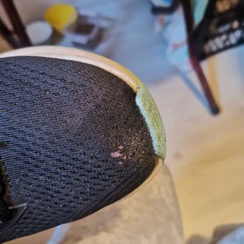 Antalya AVM Skechers Mağazasından Aldığım Ayakkabının Erken Deforme Olması Ve Garanti Talebi
