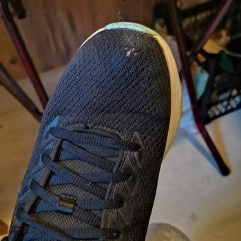 Antalya AVM Skechers Mağazasından Aldığım Ayakkabının Erken Deforme Olması Ve Garanti Talebi
