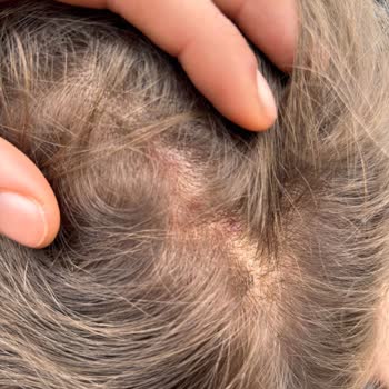 Beyaz Köşk Coiffeur Saç Boyama İşleminde Yanma Ve Yanlış Renk Sonucu Nedeniyle Ücret İadesi Talebi