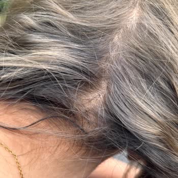 Beyaz Köşk Coiffeur Saç Boyama İşleminde Yanma Ve Yanlış Renk Sonucu Nedeniyle Ücret İadesi Talebi