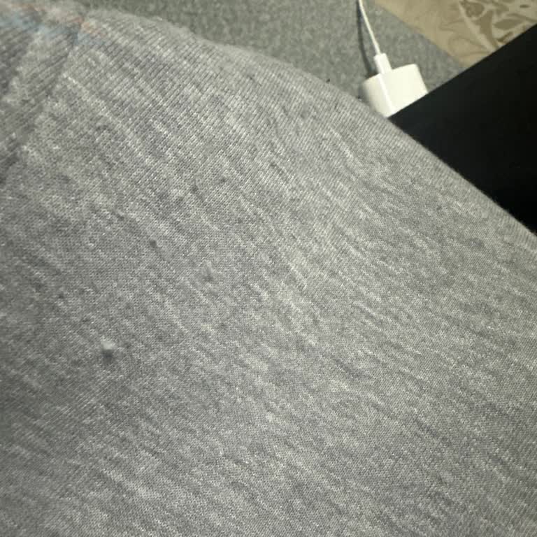 Gri Kapüşonlu Sweatshirtte Hızlı Tüylenme Ve Pullanma: Değişim Ve İade Talebi