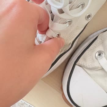 Converse Ayakkabısında Erken Deformasyon Ve Cevapsız Şikayet