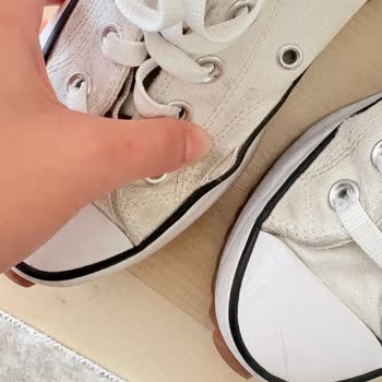 Converse Ayakkabısında Erken Deformasyon Ve Cevapsız Şikayet