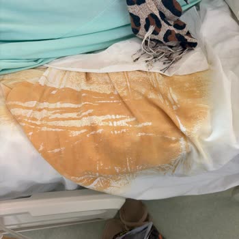 Lütfi Kırdar Şehir Hastanesi Jinekoloji Onkoloji Servisinde Kirli Çarşaf Ve Kaba Personel Davranışı