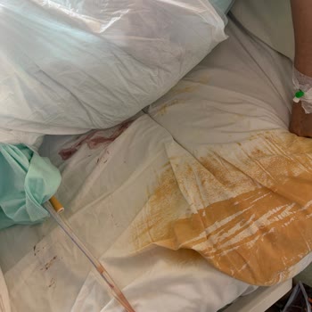Lütfi Kırdar Şehir Hastanesi Jinekoloji Onkoloji Servisinde Kirli Çarşaf Ve Kaba Personel Davranışı