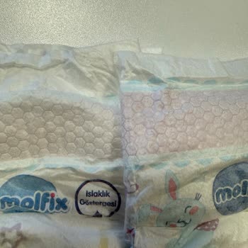 Molfix Bebek Bezinde Aşırı Sızdırma Ve Kalite Düşüşü