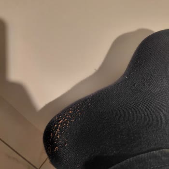 Ayakkabı Dünyası'ndan Aldığım Ayakkabı Döküntülerle Çorapları Kullanılamaz Hale Getirdi