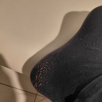 Ayakkabı Dünyası'ndan Aldığım Ayakkabı Döküntülerle Çorapları Kullanılamaz Hale Getirdi