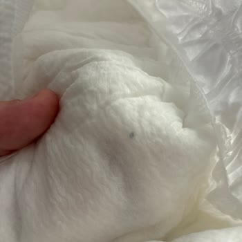 Bebek Bezinde Yabancı Madde Ve Mantar Enfeksiyonu: Ürün İadesi Ve Kalite İyileştirme Talebi