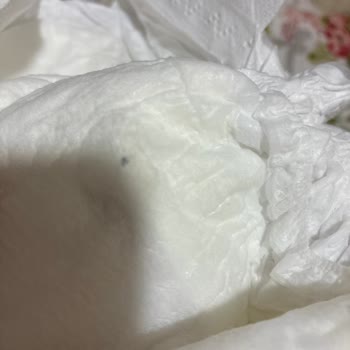 Bebek Bezinde Yabancı Madde Ve Mantar Enfeksiyonu: Ürün İadesi Ve Kalite İyileştirme Talebi