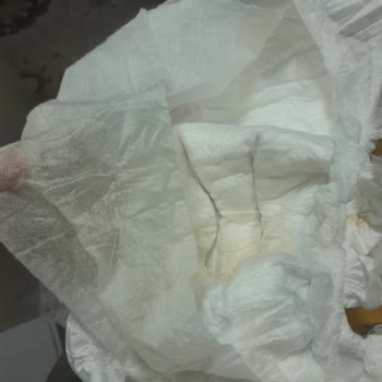 Happy.com.tr Gelen Molfix Bebek Bezleri Ve Süresi Geçmiş Uni Baby Islak Mendiller İçin Para İadesi