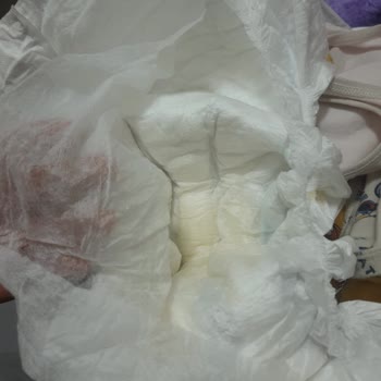 Happy.com.tr Gelen Molfix Bebek Bezleri Ve Süresi Geçmiş Uni Baby Islak Mendiller İçin Para İadesi