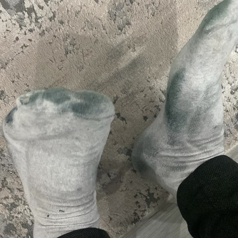 Derimod Ayakkabısının Boyası Çorapları Kirletiyor Ve Ayıplı Ürün İncelemesi Olumsuz Sonuçlandı