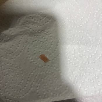 Bursa Nilüfer Görükle Trio Yaşam Merkezinde Cam Benzeri Sert Cisim İçeren Tost, Sağlık Riski