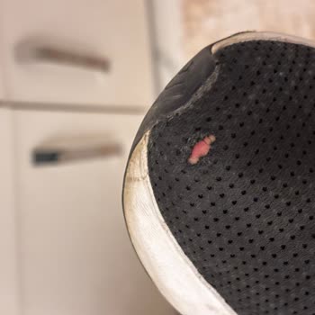 Adidas Duramo Ayakkabısında Kalite Sorunu Ve Trendyol Müşteri Hizmetinin Çözüm Yetersizliği