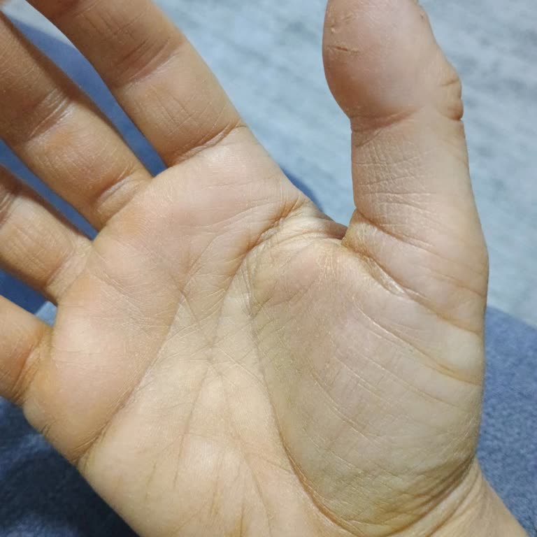 BİM Şubesinde Satılan Karayel Limon Kolonyası Ciltte Kuruluk Ve Çatlamaya Neden Oldu