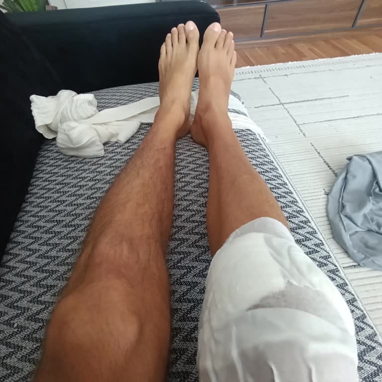 Engelli Müşterinin Su Koli Eksikliği Ve Getir'in Sorumluluk Yaklaşımı
