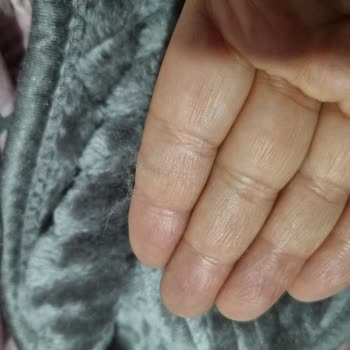 Yataş Nova Battaniye Aşırı Tüy Döküyor Ve İade Talebi