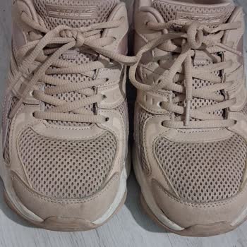 Skechers Bobs Diego Ayakkabısının Erken Deformasyonu Ve İade Talebi