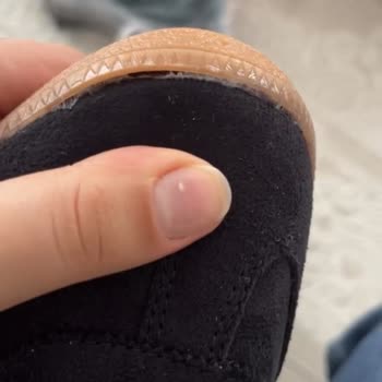 Kalitesiz Adidas Ayakkabı Ve Kargo Ücretiyle Değişim Sürecinde Satıcının Sorumluluk Reddi
