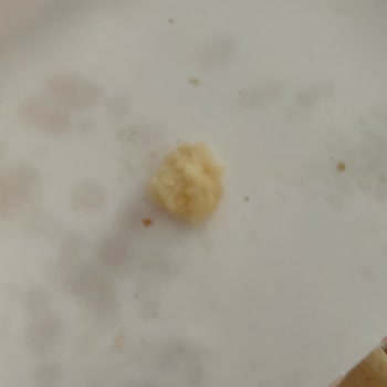 Popeyes Siparişinde Eksik Ürünler Ve Yabancı Madde, İade Sürecindeki Gecikme