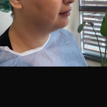 Antalya Sym Estetik Kliniğinde Gıdı Liposuction İşlemi Sonucu Hayal Kırıklığı Ve Tam İade Talebi