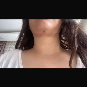 Antalya Sym Estetik Kliniğinde Gıdı Liposuction İşlemi Sonucu Hayal Kırıklığı Ve Tam İade Talebi