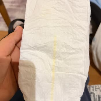 Prima Premium Care Bebek Bezlerinde Kalite Düşüşü Ve Değişim Talebi