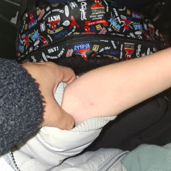 Bezmialem’de Çocuk Hastanesi Deneyiminde Damar Yolu Açılmaması Ve Haksız Ücret İadesi