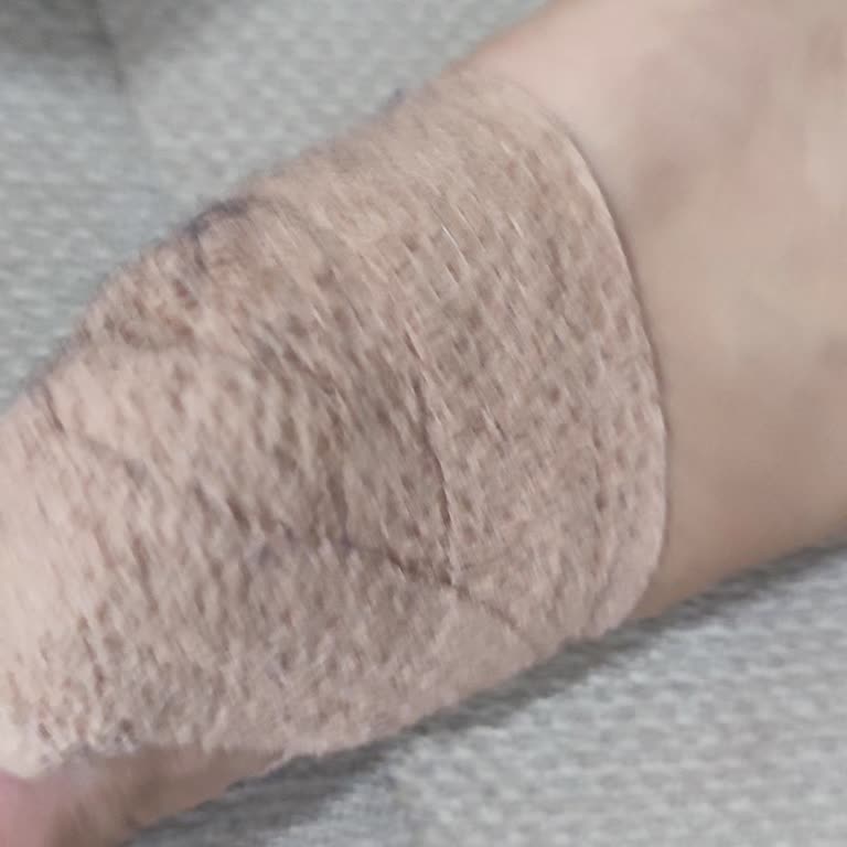 Fazla Cerrahi Müdahale Ücreti Ve Şişirilmiş Faturaya İtiraz