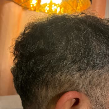 Yeni Berberin Özensiz Kesimi Müşteriyi Mahcup Bıraktı