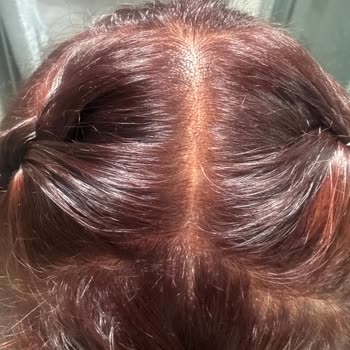 Garnier Patlıcan Moru Saç Boyasında Renk Uyumsuzluğu Ve Kırmızı Ton Sorunu