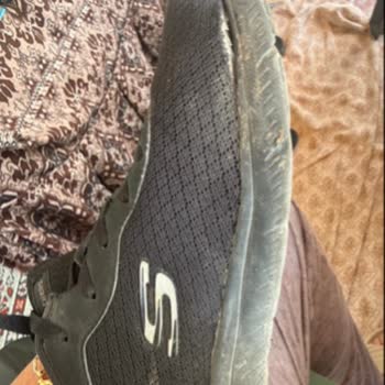 Skechers Summits Ayakkabısında Açılan Dikiş İçin İade Reddi