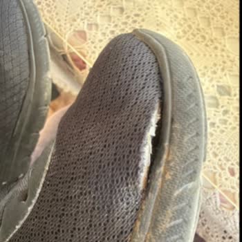 Skechers Summits Ayakkabısında Açılan Dikiş İçin İade Reddi