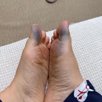 In Street Mağazasındaki Puma Kadın Spor Ayakkabısında Yağmur Sonrası Boya Sızıntısı Ve Renk Değişimi
