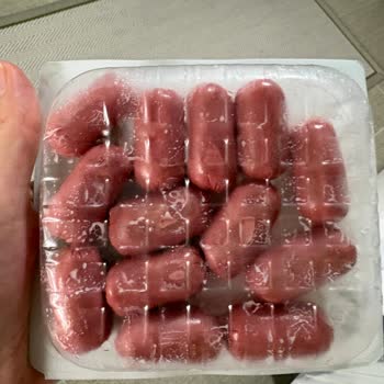 Pınar Açık Büfe Hindi Kokteyl Sosisinin Tarihine Rağmen Bozulması Ve Güven Kaybı