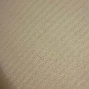 DoubleTree By Hilton Gaziantep’te Hijyen İhlali Ve Güvensiz Personel Girişi