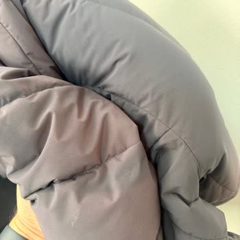 Adidas Montunda Erken Renk Solması Ve Kalite Sorunu
