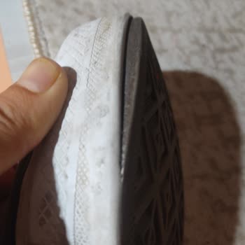 Converse Ayakkabısında Taban Açılması Ve In Street Mağazasının Garanti Reddi