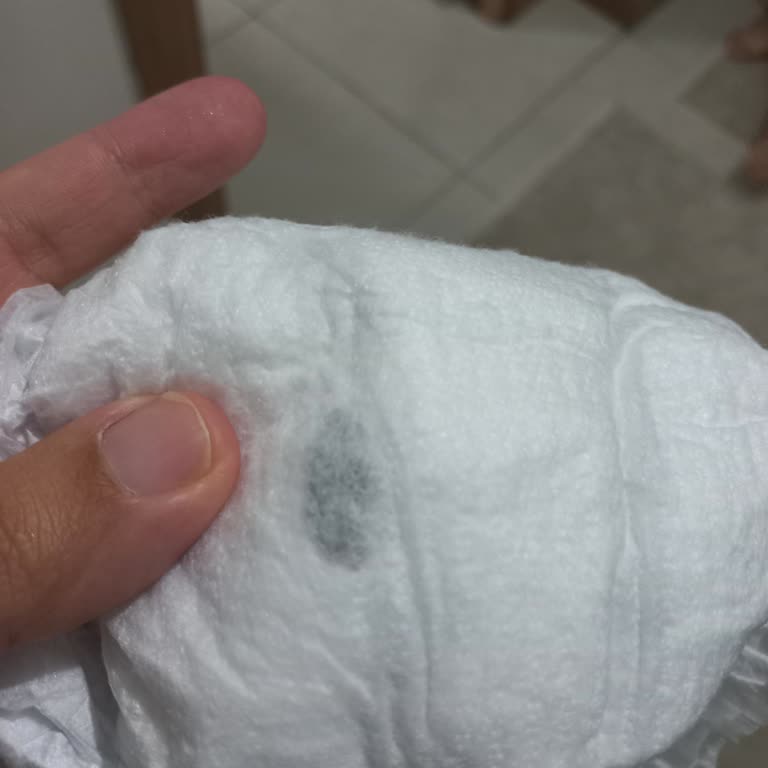 Molfix Bebek Bezinde Bulunan Siyah Sert Yabancı Madde Güven Endişesi