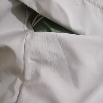 Ayıplı Trençkot Ve Cevapsız Müşteri Hizmeti