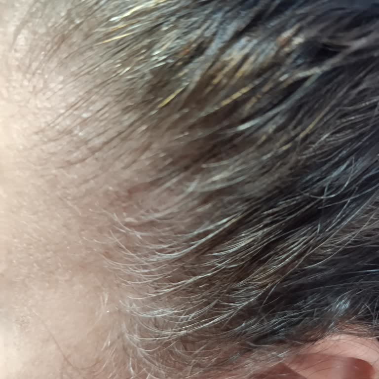 L'Oreal Saç Boyası Beyazları Yüzde Yüz Kapatmadı İade Talep Ediyorum