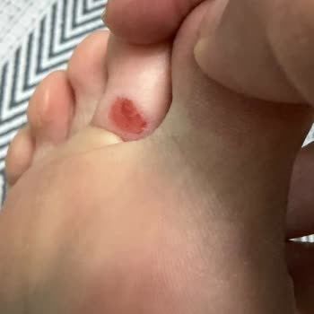 Eataly Shoes’ta Mila Model Terlikte Ciddi Deri Hasarı Ve Yetersiz Çözüm