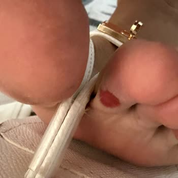 Eataly Shoes’ta Mila Model Terlikte Ciddi Deri Hasarı Ve Yetersiz Çözüm