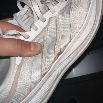 Adidas Ayakkabısının İki Ayda Yanlarından Açılması Ve Garanti Hakkının İhlali